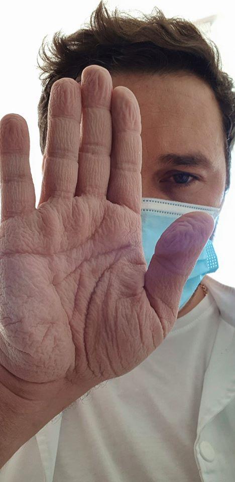 Cum arată mâna unui chirurg, care a stat 4 ore în operație la 28 de grade ca să salveze o viață 670202