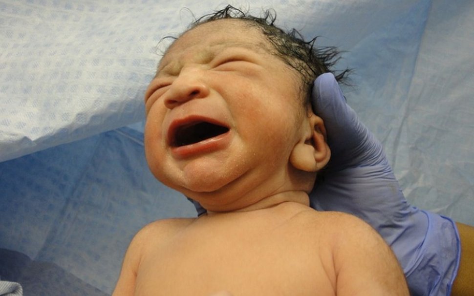 Bebelușul care a venit lume, chiar dacă părinții nu l-au dorit. Medicii au fost șocați când s-au uitat la mâinile copilului