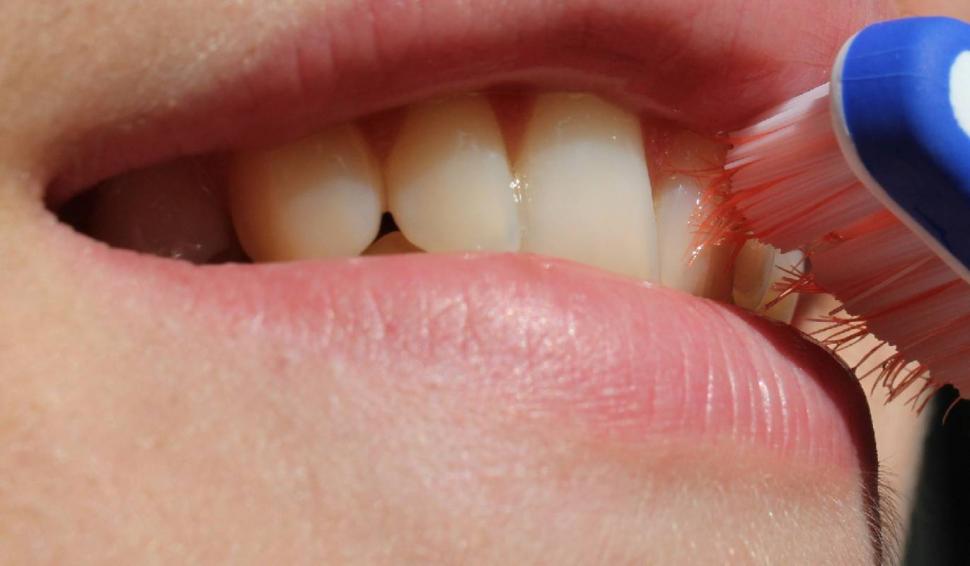 Efect neaşteptat al pandemiei de COVID-19. Dentiştii sunt uluiţi 679009