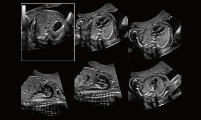 Care este diferenta dintre ecografia 2D, 3D si 4D? 679212