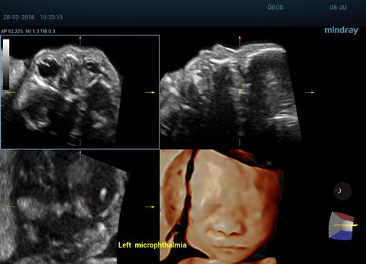 Care este diferenta dintre ecografia 2D, 3D si 4D? 679214