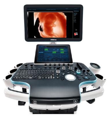 Care este diferenta dintre ecografia 2D, 3D si 4D? 679217