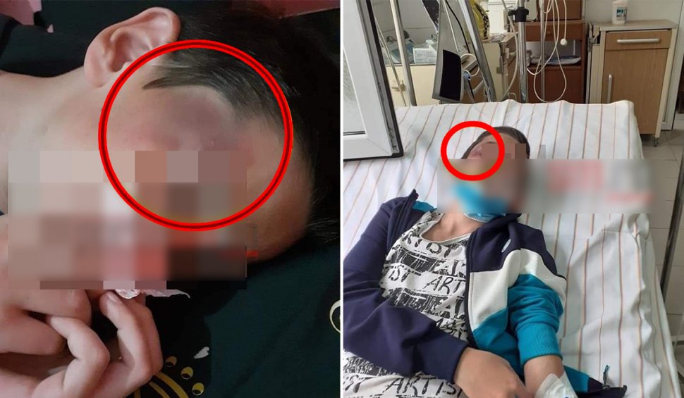 Un copil bătut de tatăl vitreg a fost machiat de mama lui ca rănile să pară mai grave