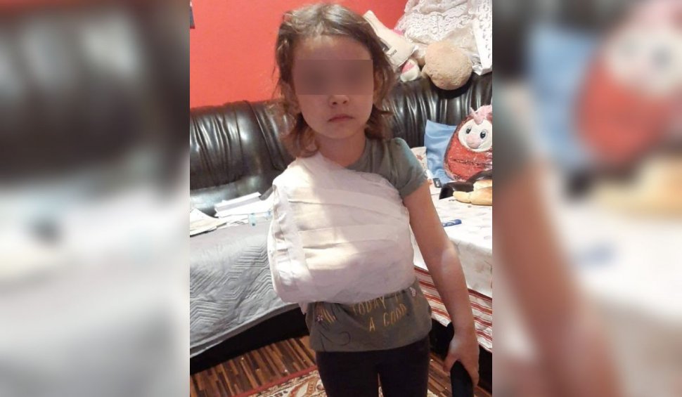 Medic ortoped la spitalul din Corabia acuzat că i-a pus ghipsul peste tricou unei fetițe de 4 ani