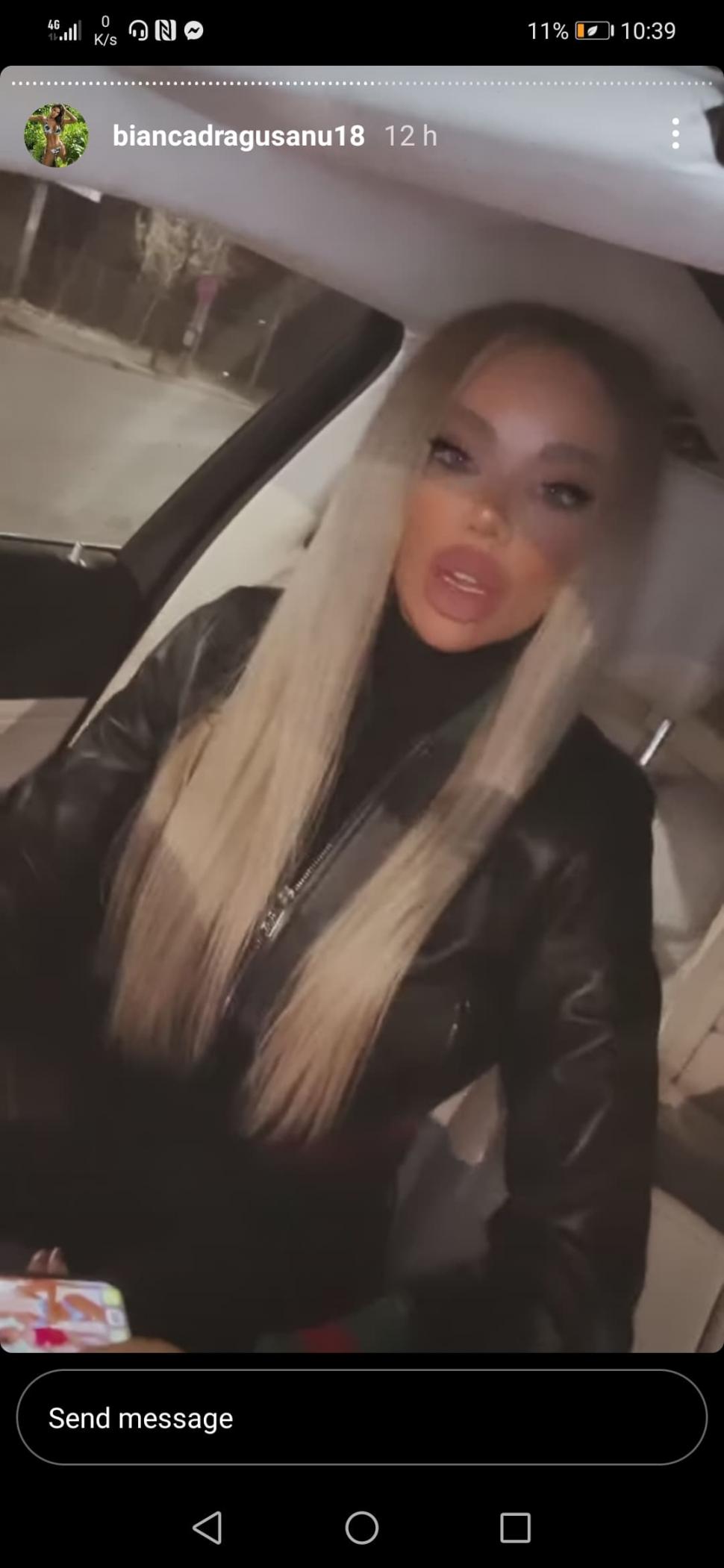 Bianca Drăgușanu a publicat pozele după bătaia primită de la Alex Bodi: ”Am un sfat: nu treceți cu vederea agresivitatea!” 694421