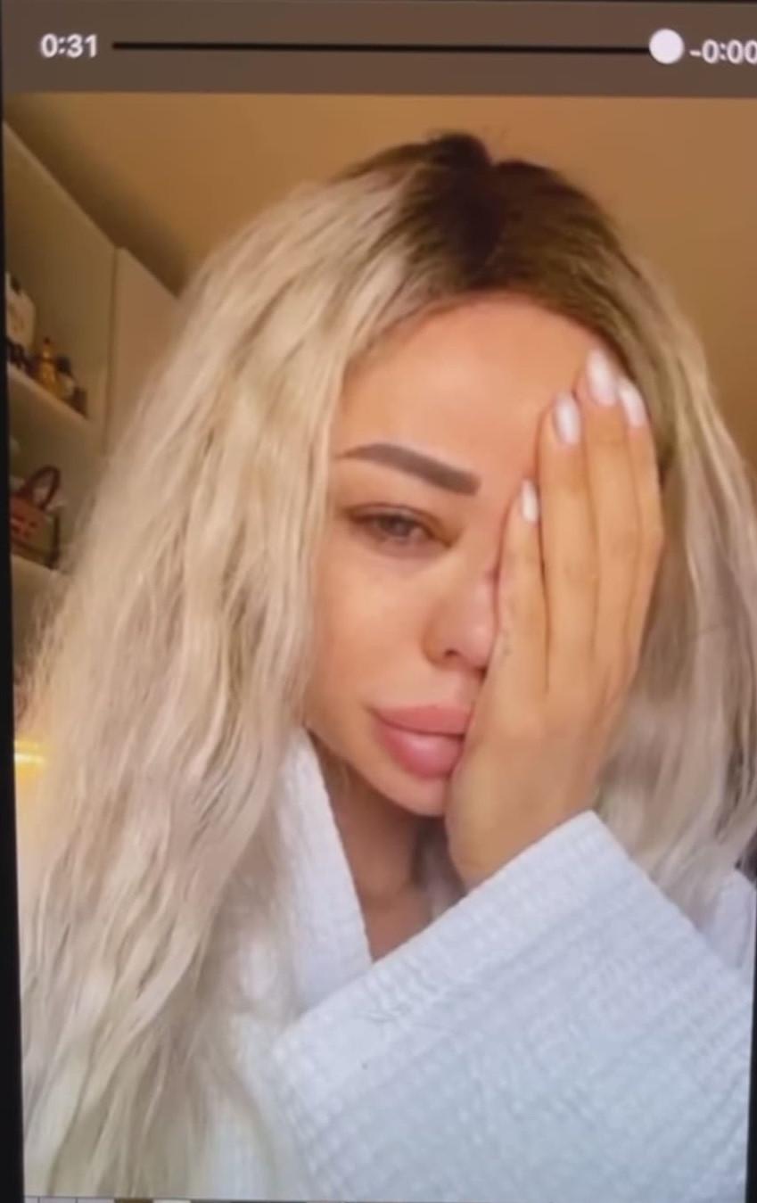 Bianca Drăgușanu a publicat pozele după bătaia primită de la Alex Bodi: ”Am un sfat: nu treceți cu vederea agresivitatea!” 694423