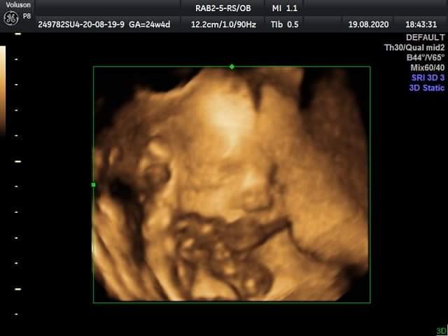 I-a murit fiica după ce medicii nu au primit-o la maternitate să nască: "Au venit mămici cu cordonul ieşit, doar nu o să moară la tine" 698872