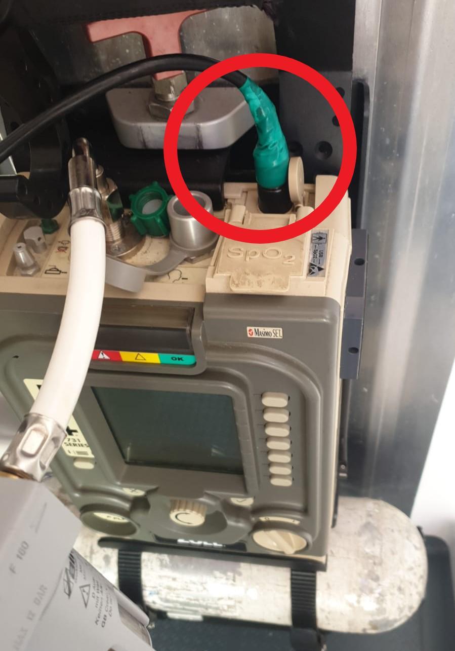 De ce a murit angajatul DSP Gorj în ambulanţă. Raportul Corpului de Control: cablurile de la ventilatorul de oxigen, lipite cu bandă adezivă 699041