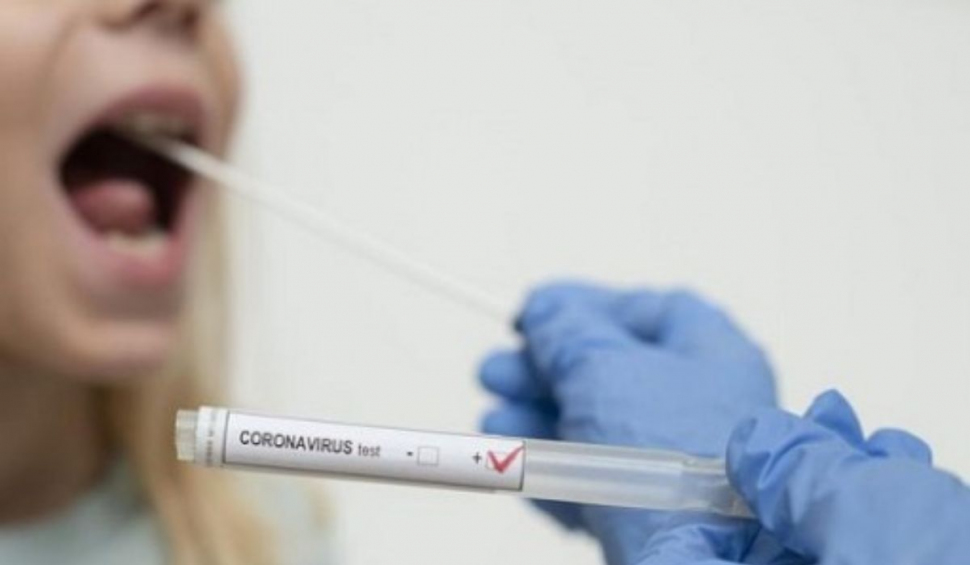 Prețul testelor COVID la un an de pandemie