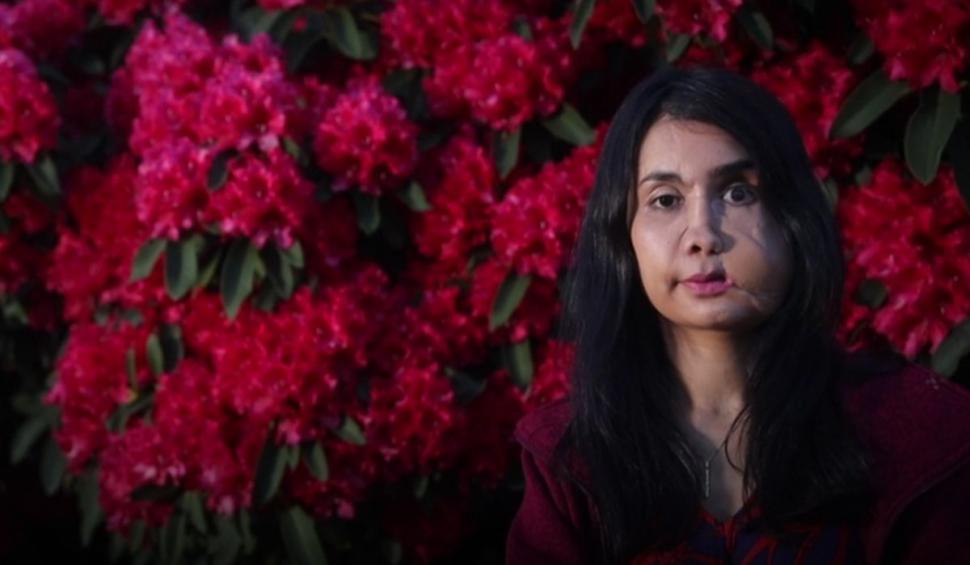 O femeie a supraviețuit după ce a fost împușcată în față de soțul său. Operată de 22 de ori, ea apără acum cauza femeilor din Afganistan 716143