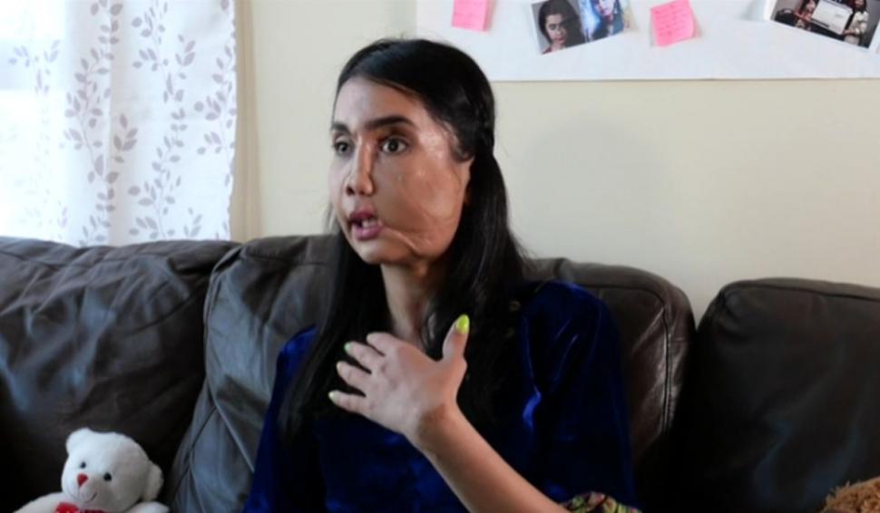 O femeie a supraviețuit după ce a fost împușcată în față de soțul său. Operată de 22 de ori, ea apără acum cauza femeilor din Afganistan 716145