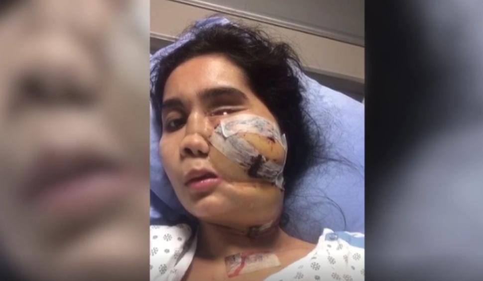 O femeie a supraviețuit după ce a fost împușcată în față de soțul său. Operată de 22 de ori, ea apără acum cauza femeilor din Afganistan 716147