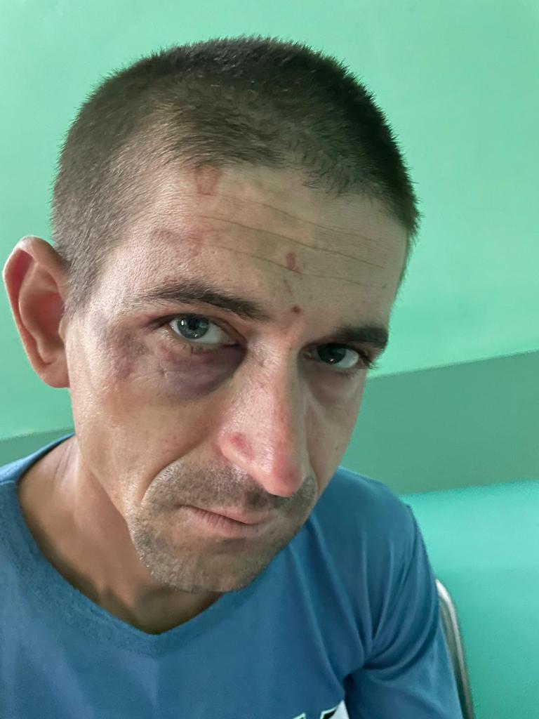 Bărbat bătut crunt în secția de poliție de mai mulți jandarmi. Gorjeanul are urme de bocanci pe față 718687