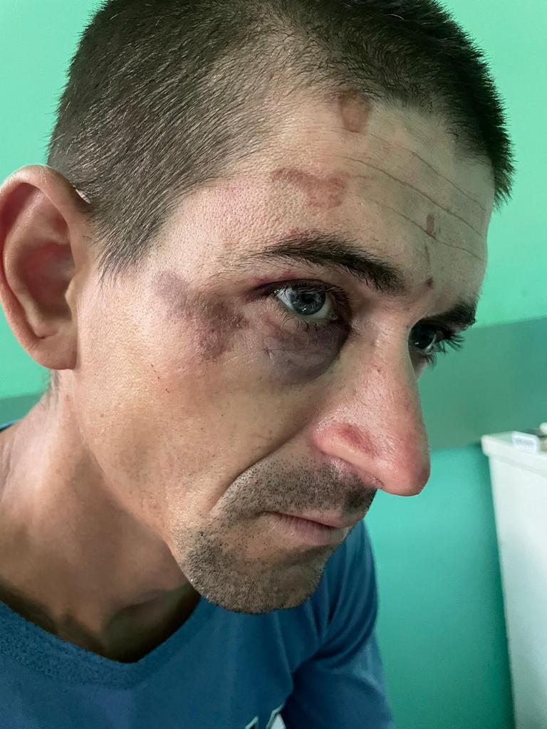 Bărbat bătut crunt în secția de poliție de mai mulți jandarmi. Gorjeanul are urme de bocanci pe față 718688