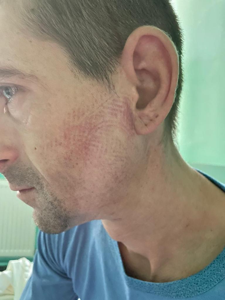 Bărbat bătut crunt în secția de poliție de mai mulți jandarmi. Gorjeanul are urme de bocanci pe față 718689