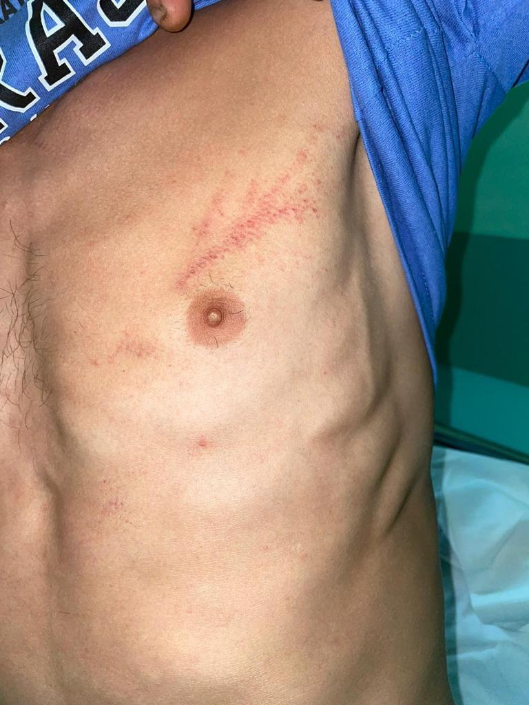 Bărbat bătut crunt în secția de poliție de mai mulți jandarmi. Gorjeanul are urme de bocanci pe față 718690