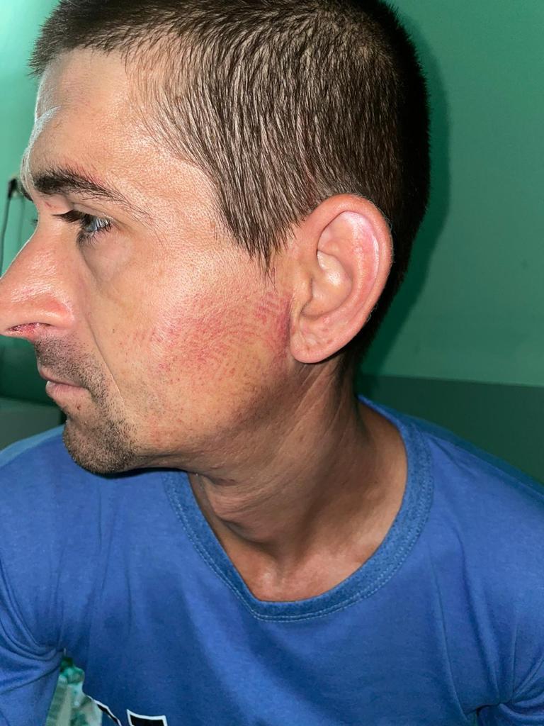 Bărbat bătut crunt în secția de poliție de mai mulți jandarmi. Gorjeanul are urme de bocanci pe față 718691