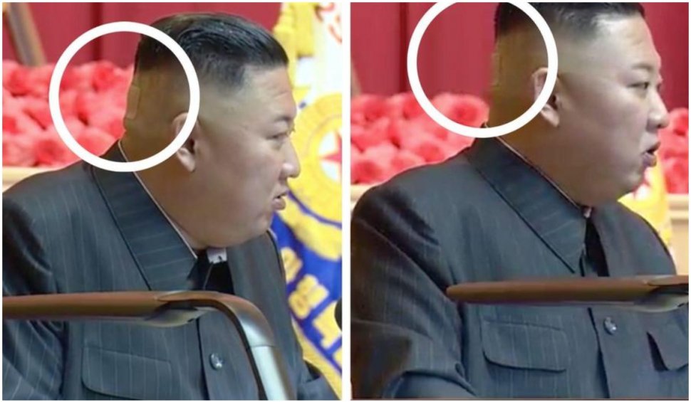 Speculațiile privind problemele de sănătate ale liderului nord-coreean au fost alimentate de ultima sa apariție