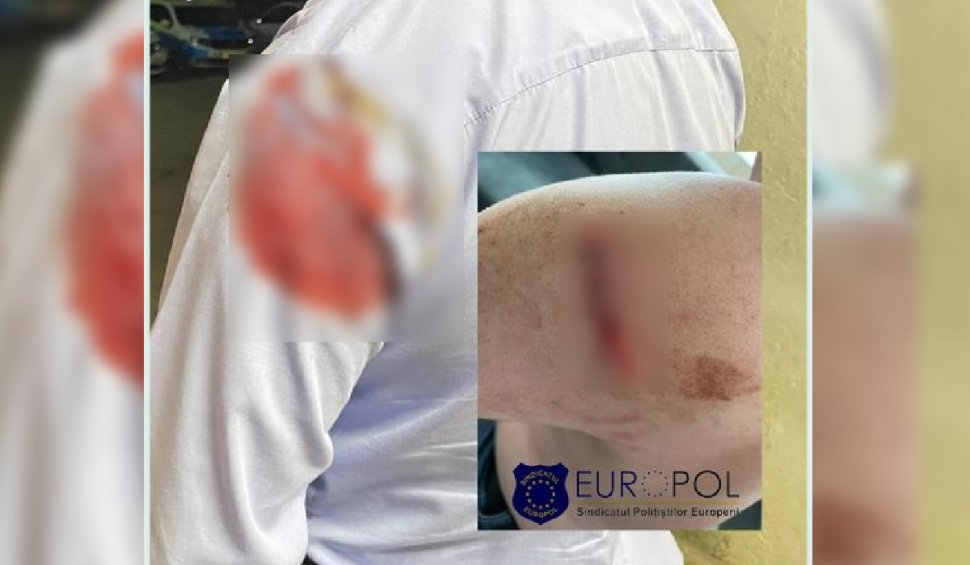 Sindicatul Europol, revoltat de decizia unui procuror: "Un polițist lovit cu sapa în zona capului în timpul unei intervenţii, considerat vinovat"