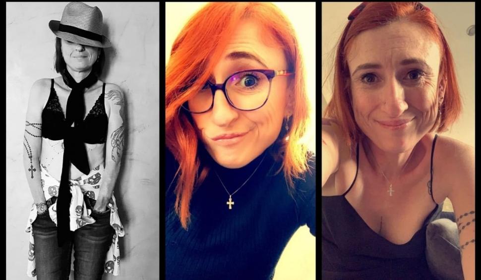 O femeie a rămas fără mâini și picioare după ce s-a dus la clinică pentru o simplă examinare de rutină, în Franța 723001