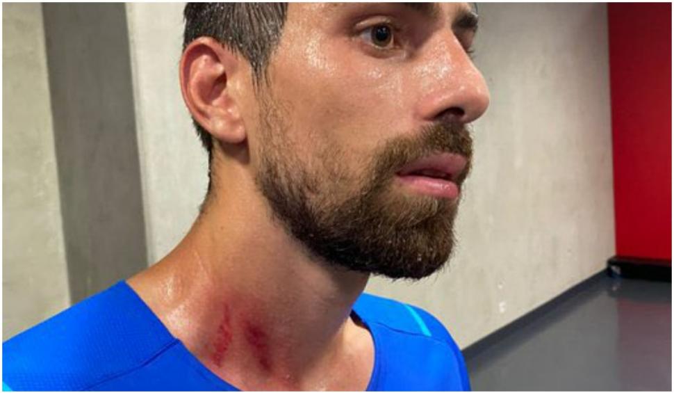 Bătaie generală în Franţa: Fanii lui Nice au invadat terenul în meciul cu Marseille 723328