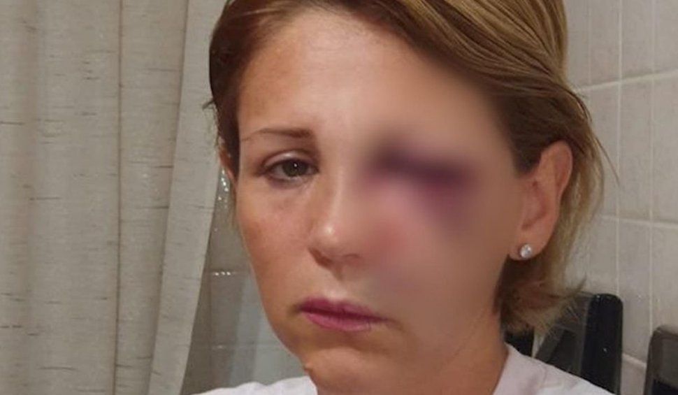 O româncă a fost bătută cu bestialitate într-un magazin din Italia. Niciun cumpărător nu a intervenit pentru a o ajuta