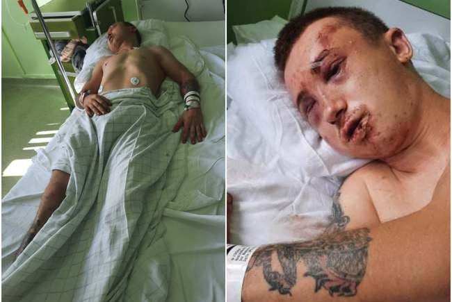 Băiat bătut, dezbrăcat, incendiat și lăsat să moară pe un trotuar, în Arad