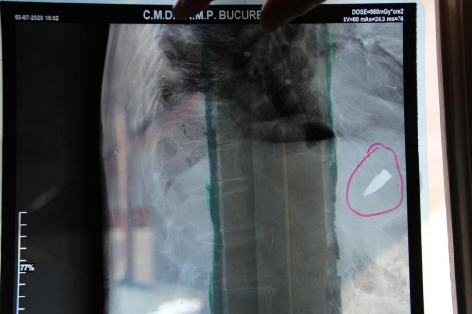 Veteranul de război care trăiește de 8 decenii cu un glonț lângă inimă. "Am stat peste o lună în spital, iar, ulterior, comisia de evaluare a decis să revin pe front" 738967