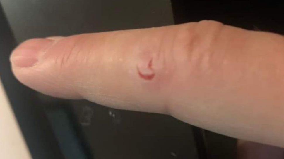 O veveriţă care a atacat și rănit 18 oameni în două zile a fost prinsă în Marea Britanie. Soarta i-a fost pecetluită 743091