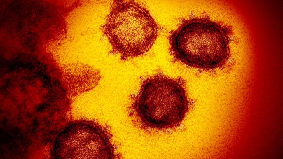 Deltacron, noua tulpină de coronavirus descoperită la 25 de oameni din Cipru