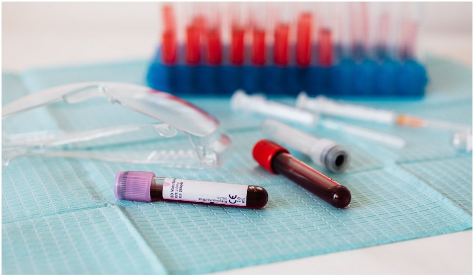 Un simplu test de sânge poate arăta ce pacienți vor muri de COVID