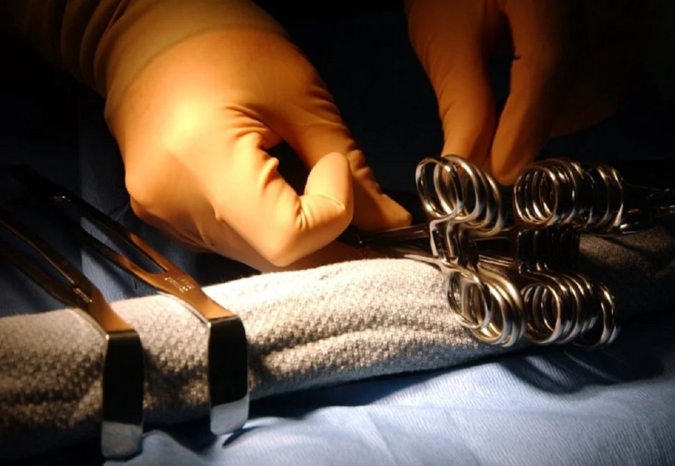 Un medic din Timişoara a uitat o spatulă în abdomenul unei paciente. Obiectul a fost descoperit după patru ani