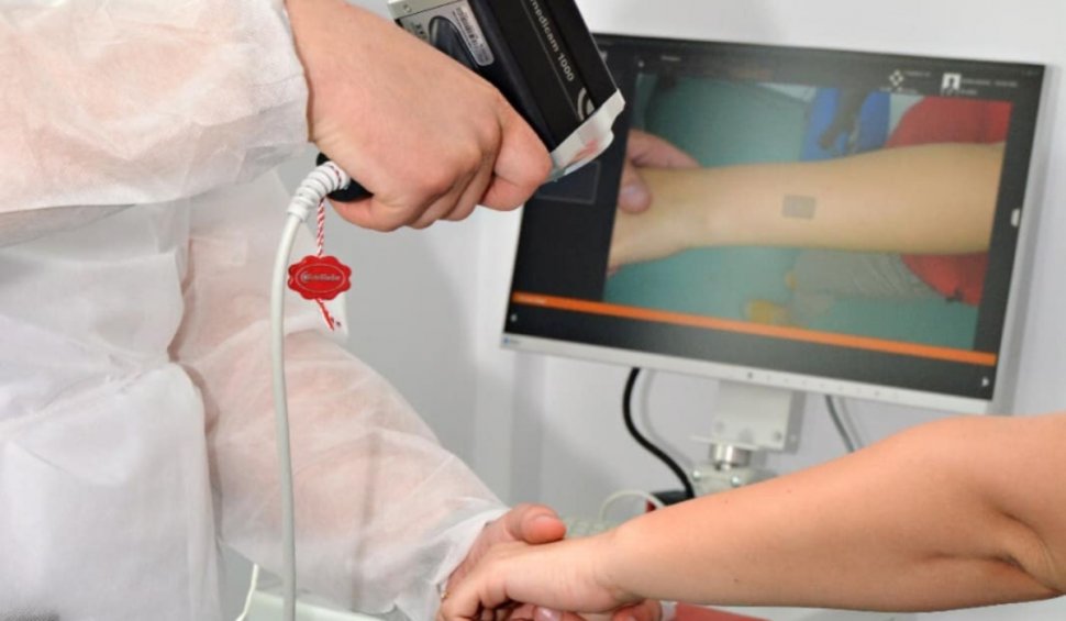 Spital din Galați, dotat cu un aparat unic în România care descoperă cancerul de piele