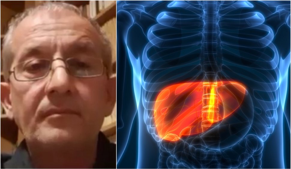 Dr. Cătălin Apostolescu explică diferenţa dintre hepatita misterioasă şi boala Wilson: "Ne aşteptăm la asta în viitorul apropiat"