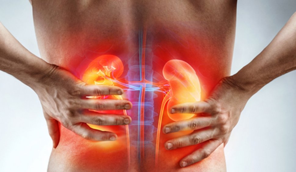 Simptomul care face diferenţa între durerea de spate sau de rinichi | Precizările unui cunoscut medic urolog