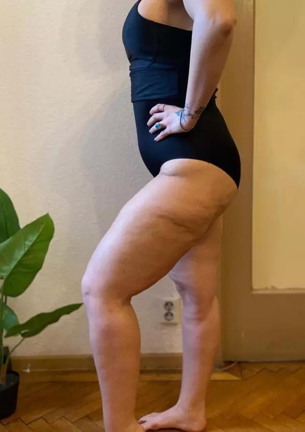 Oana Radu, înainte și după ce a slăbit. "Acestea sunt urmele pe care mâncarea le lăsase pe corpul meu" 779749