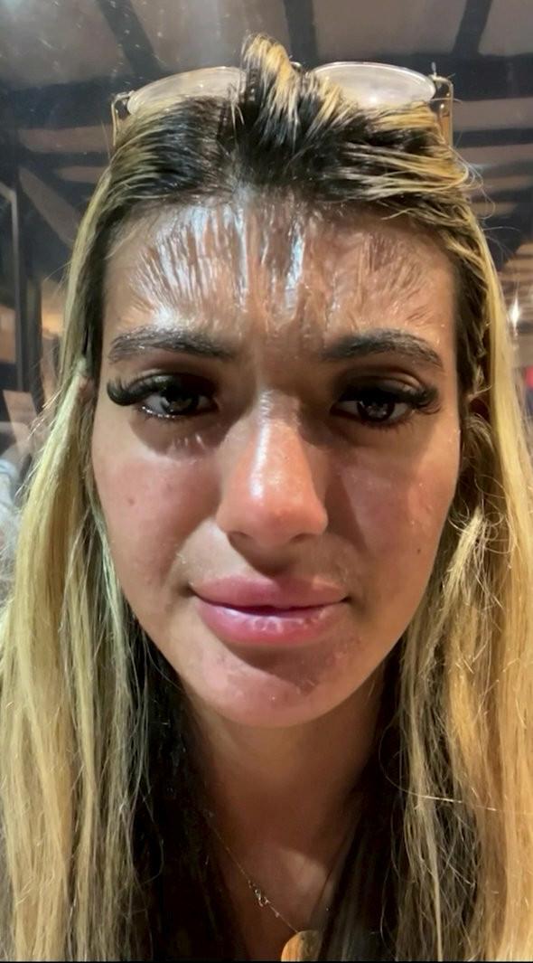 O turistă a adormit pe o plajă din Bulgaria frecventată de o mulțime de români | Când s-a trezit a ajuns direct la medic 786003