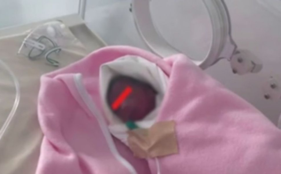 Un bebeluş de doar 500 de grame a venit pe lume la Constanţa
