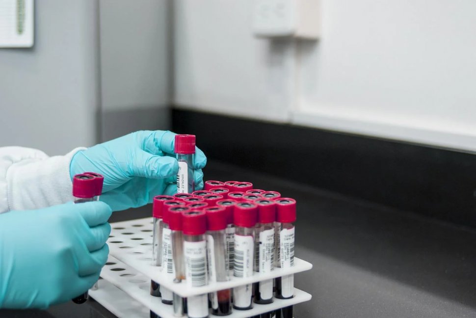Testul de sânge care ar putea depista cancerul înainte de orice simptom