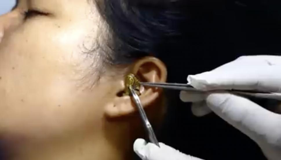 Un ”chirurg” se chinuie să scoată un șarpe viu din urechea unei femei | Clipul a devenit viral 789477