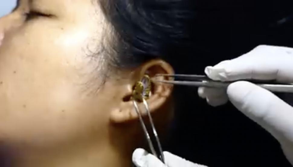 Un ”chirurg” se chinuie să scoată un șarpe viu din urechea unei femei | Clipul a devenit viral 789478