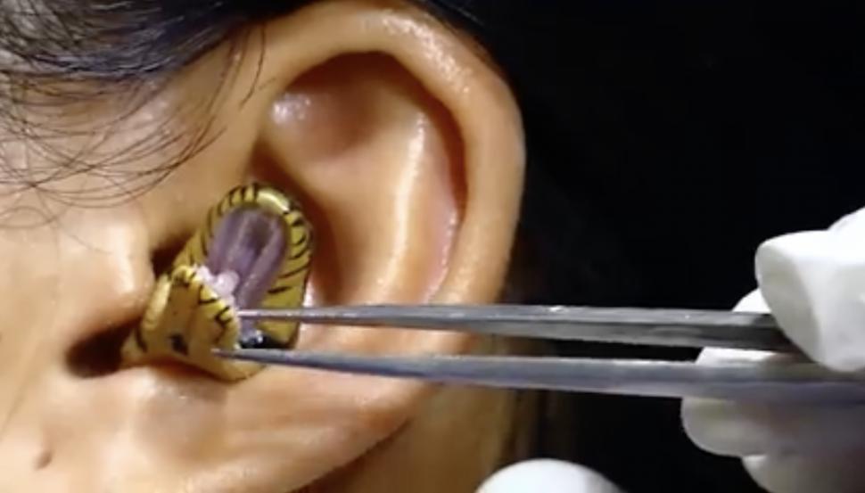 Un ”chirurg” se chinuie să scoată un șarpe viu din urechea unei femei | Clipul a devenit viral 789479