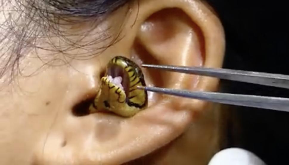 Un ”chirurg” se chinuie să scoată un șarpe viu din urechea unei femei | Clipul a devenit viral 789480