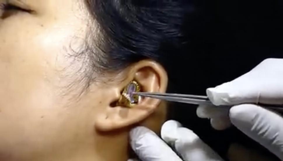 Un ”chirurg” se chinuie să scoată un șarpe viu din urechea unei femei | Clipul a devenit viral 789481