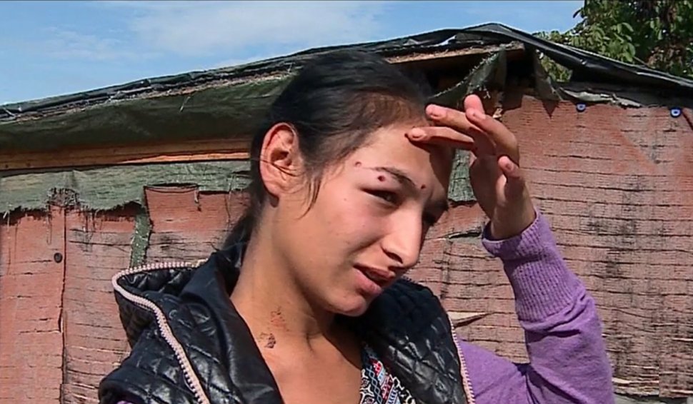O tânără de 18 ani, împuşcată în timp ce mergea pe stradă la Târgu Mureș. Zgomotul de armă i-a alarmat pe localnici