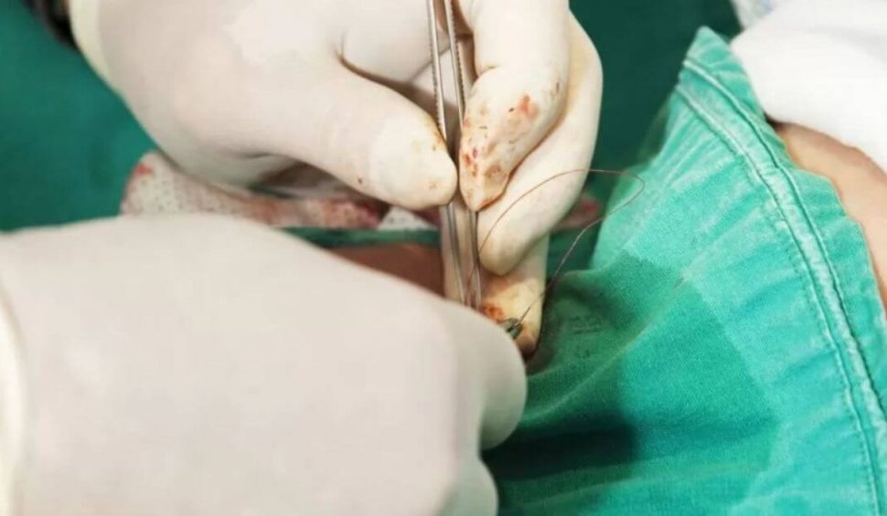 Cinci beneficii ale operației de circumcizie