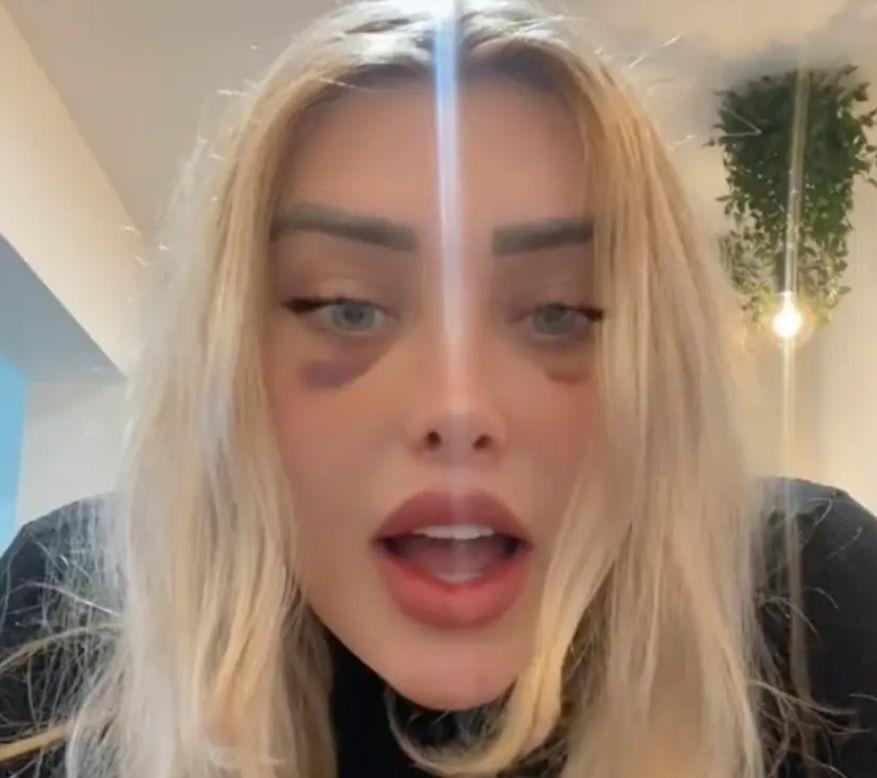 Un model spune că "i-a explodat capul" în timp ce era în avion. "Am auzit un zgomot puternic, apoi inima a început să îmi bată cu putere" 796417