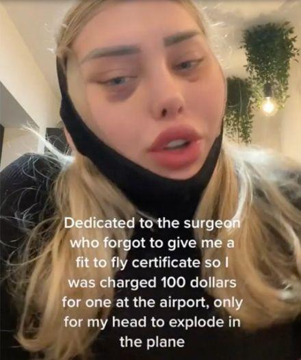 Un model spune că "i-a explodat capul" în timp ce era în avion. "Am auzit un zgomot puternic, apoi inima a început să îmi bată cu putere" 796420