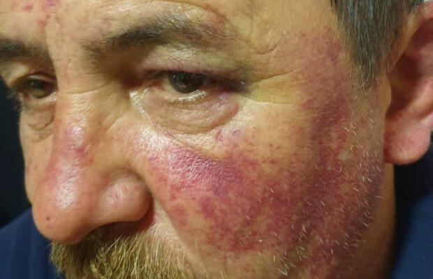 Bărbat bătut cu parul, aruncat în Dunărea înghețată și abandonat la tomberon de trei polițiști, în Caraș-Severin 798188