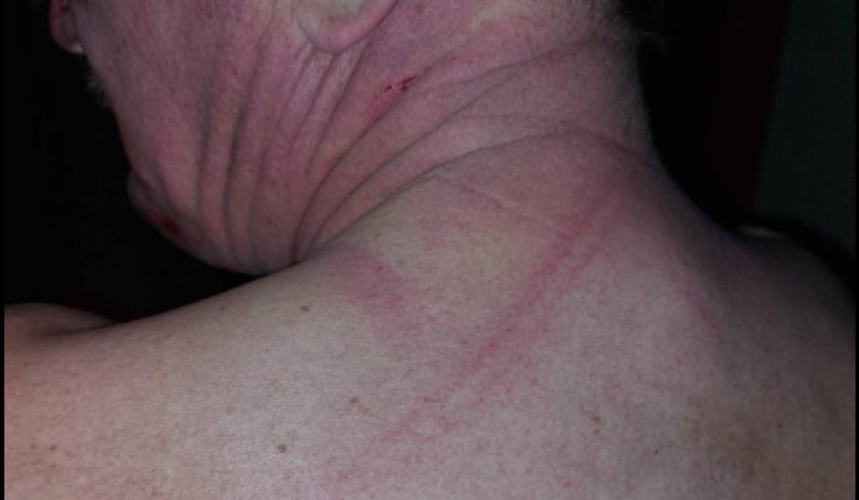 Un primar le-a spart nasul mai multor politicieni, după un meci de fotbal, în Timiș 802734